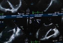 Mujer en Egipto descubre embarazo de nueve bebés; médicos alertan por el alto riesgo