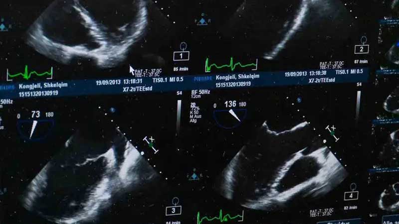 Mujer en Egipto descubre embarazo de nueve bebés; médicos alertan por el alto riesgo